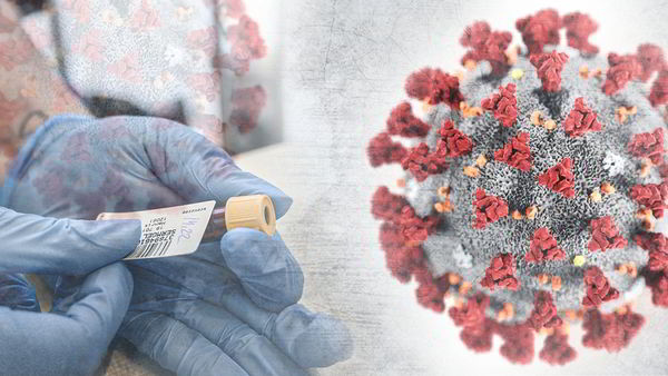 В Швеции обнаружено 15 случаев Мю-коронавируса